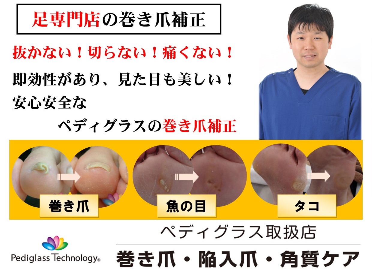 宝塚で巻き爪でお悩みならペディグラス巻き爪補正のあさひ整骨院・整体 