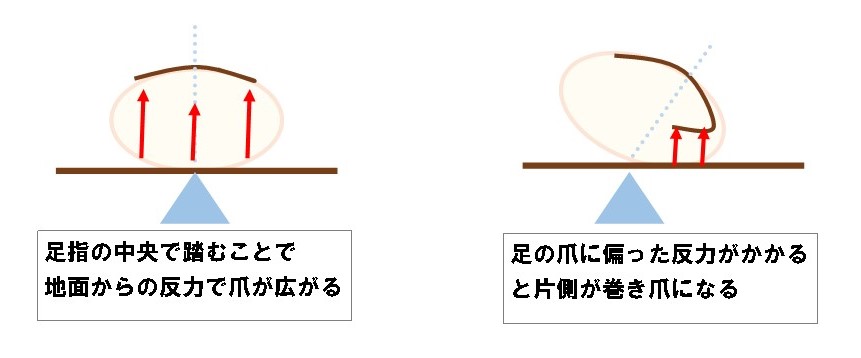 巻き爪になる理由